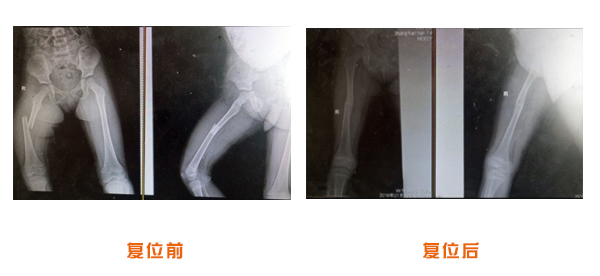 前后对比