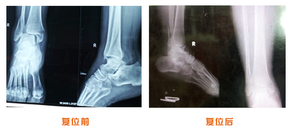 前后对比