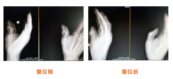 前后对比